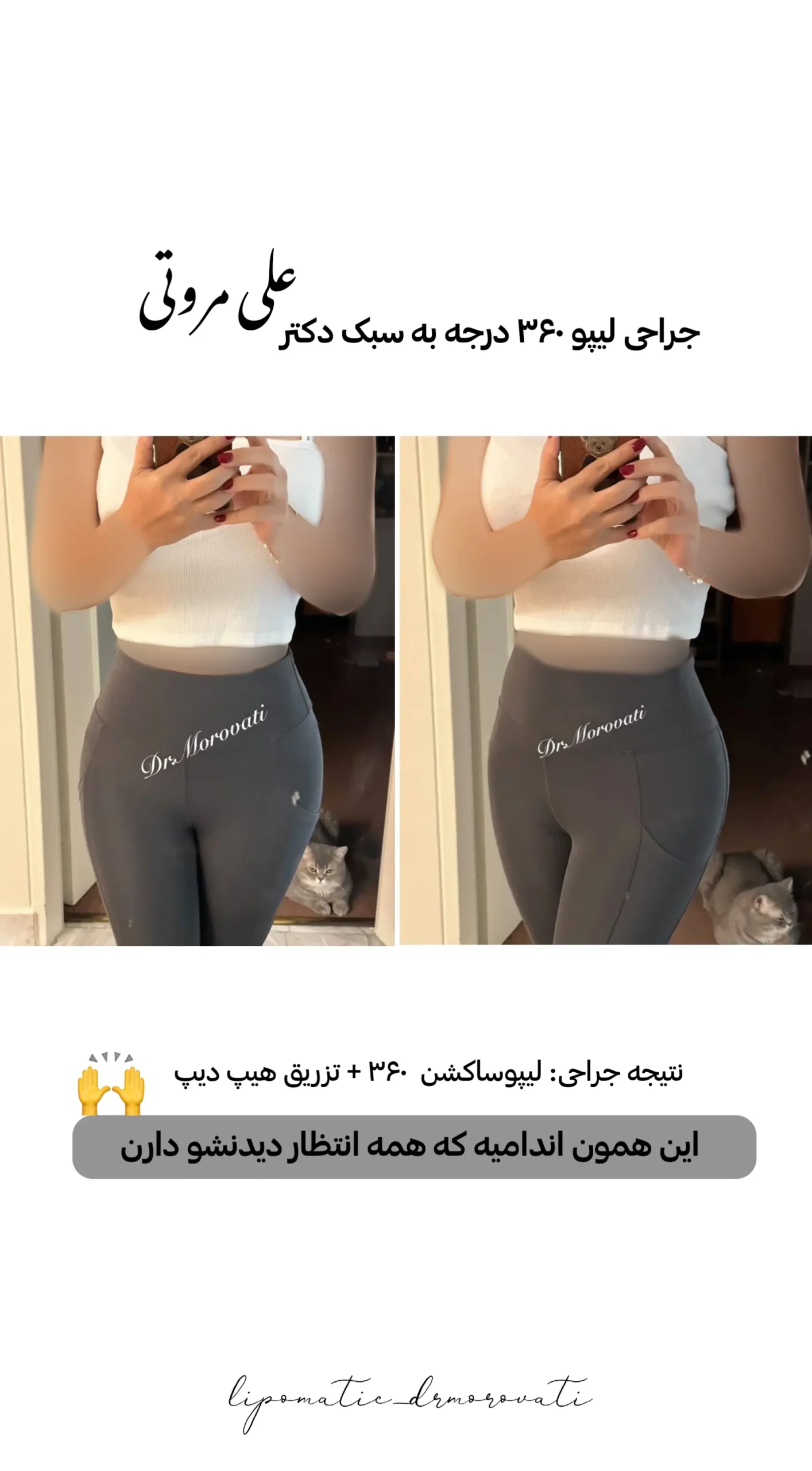 نتیجه جراحی دکتر مروتی ۲