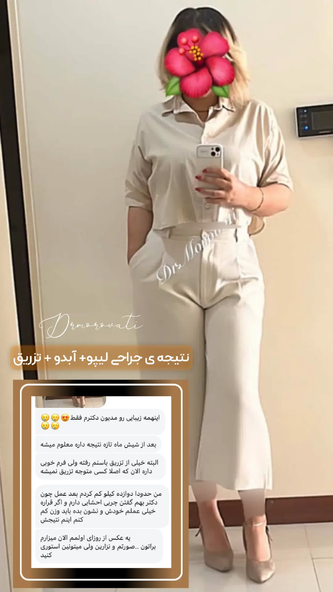 نتیجه جراحی دکتر مروتی ۳