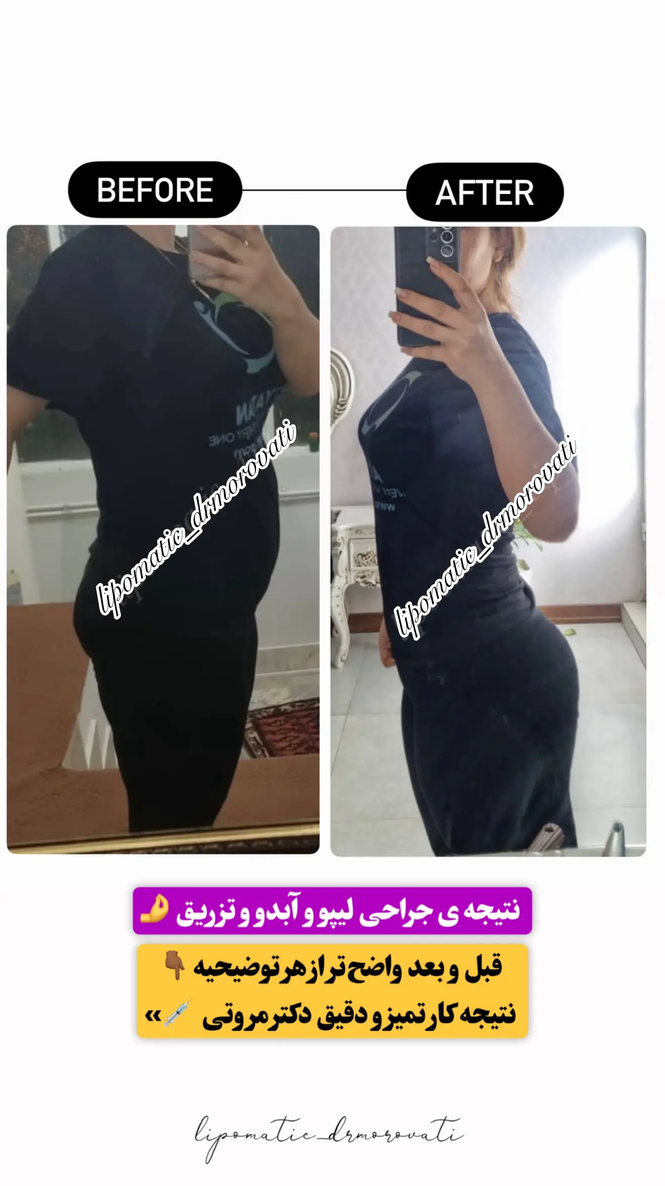 نتیجه جراحی دکتر مروتی ۱