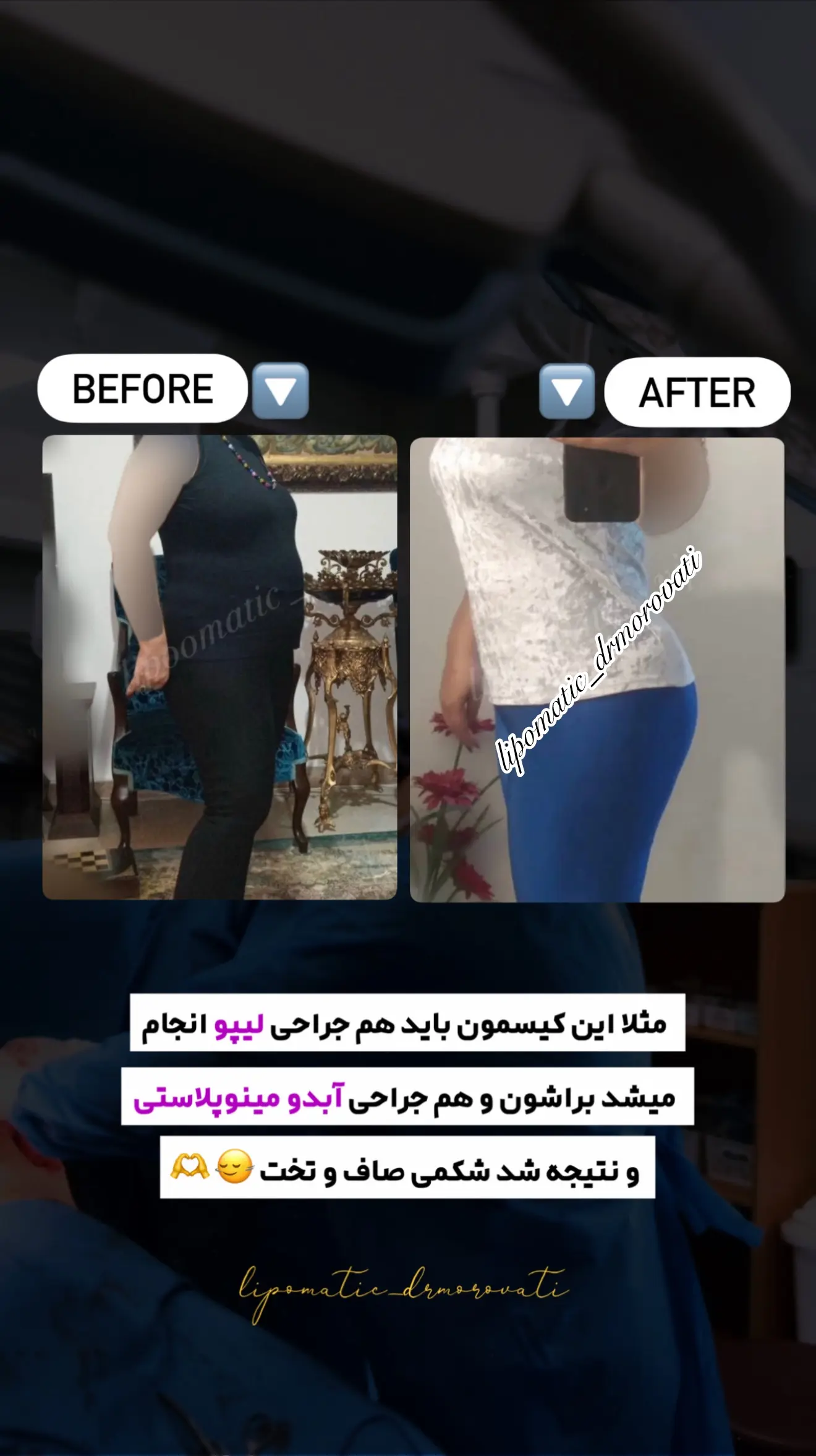 نتیجه جراحی دکتر مروتی ۴