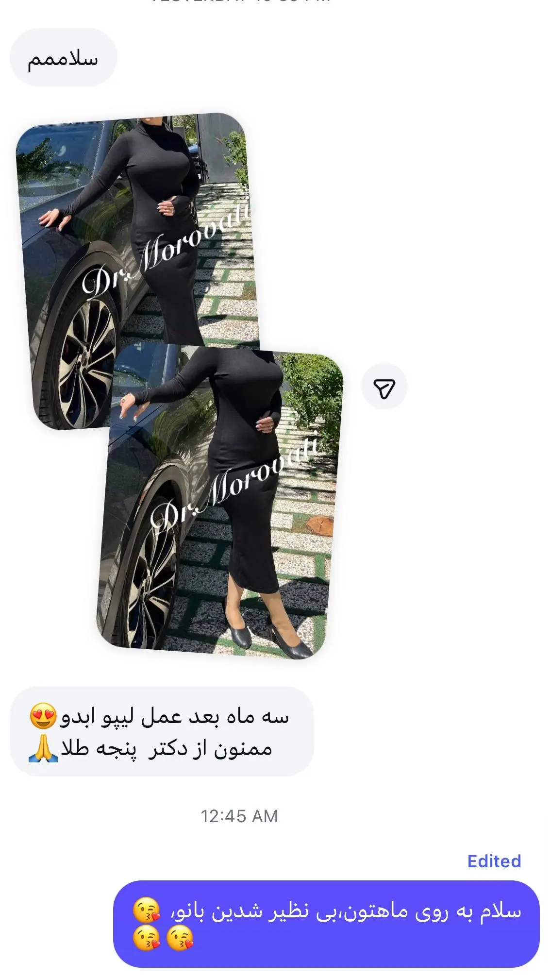 نتیجه جراحی دکتر مروتی ۷
