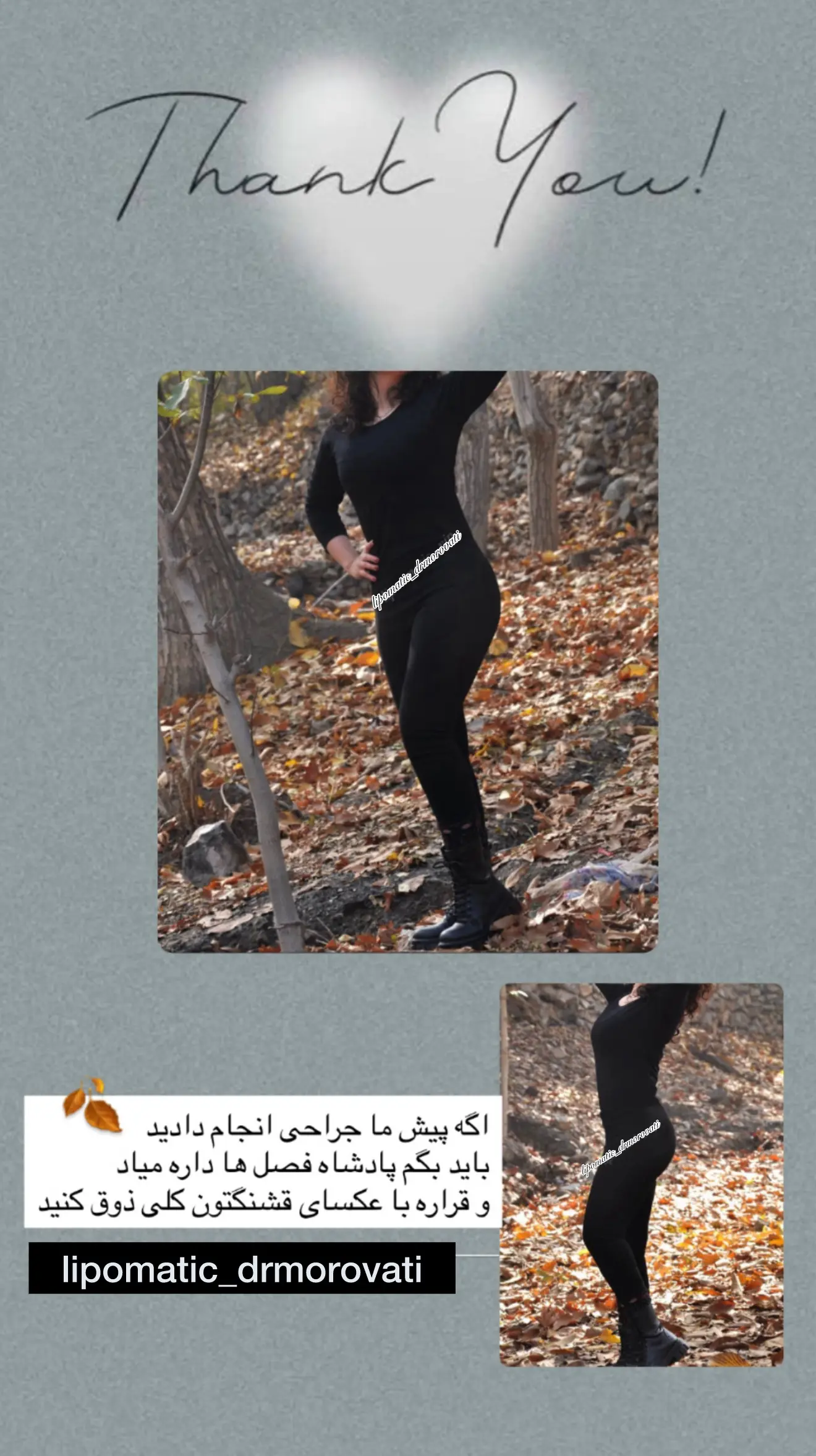 نتیجه جراحی دکتر مروتی ۶