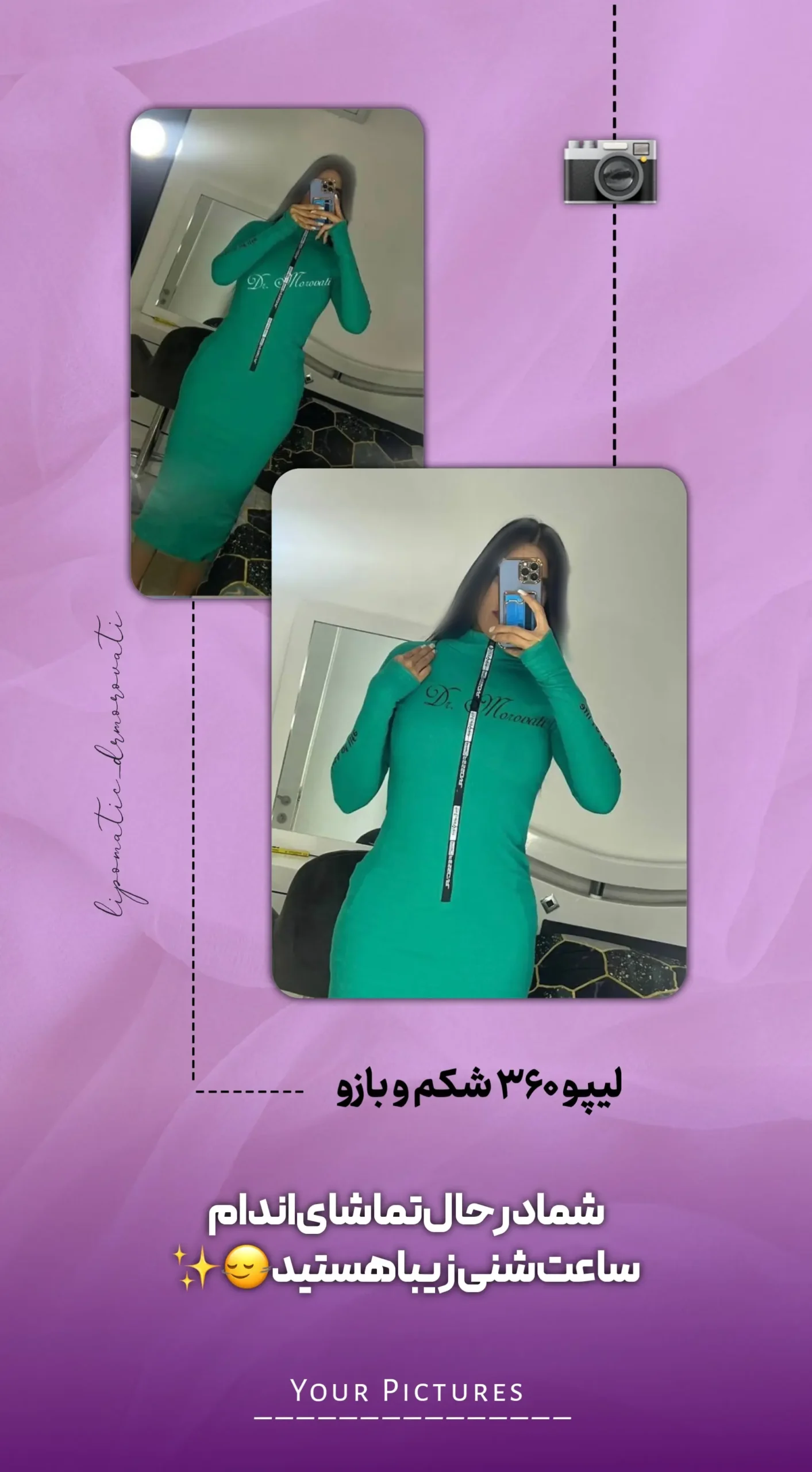 نتیجه جراحی دکتر مروتی ۸