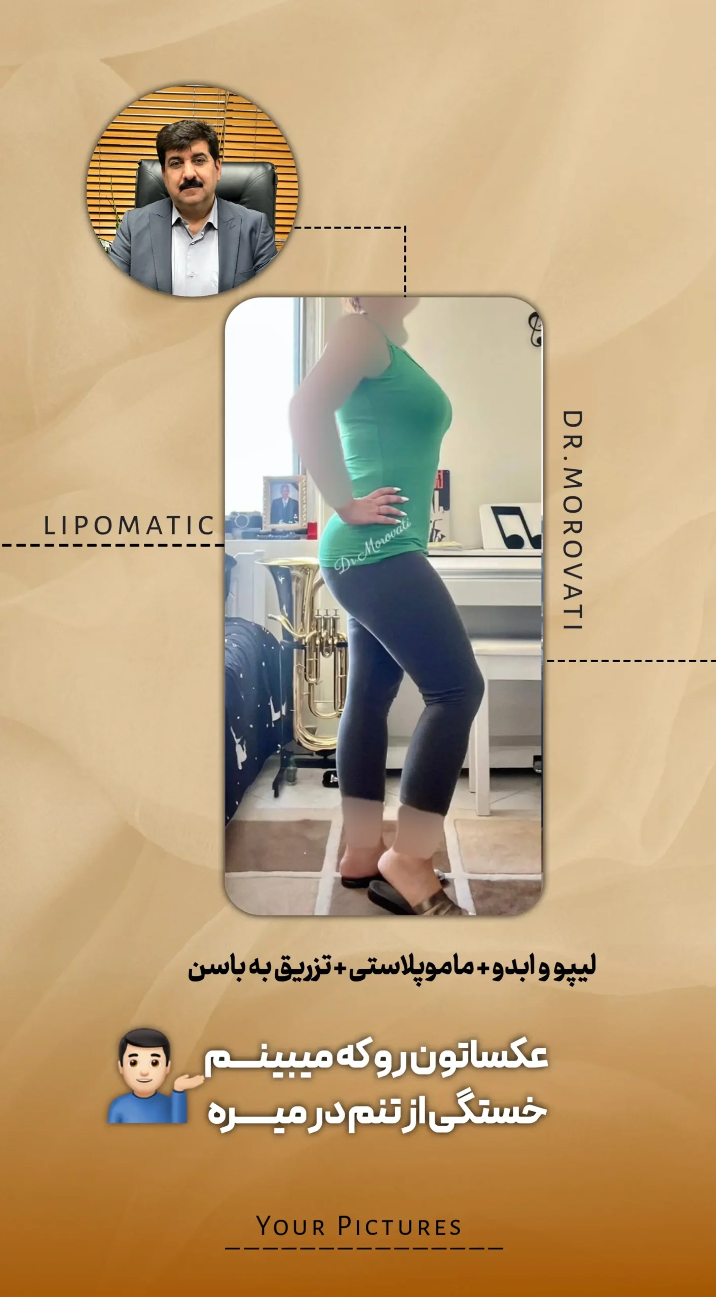 نتیجه جراحی دکتر مروتی ۱۰