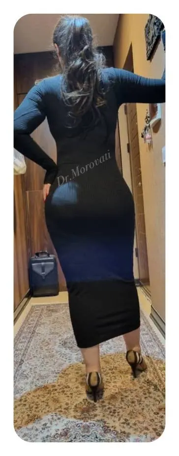 نتیجه ابدومینوپلاستی برای اصلاح افتادگی پوست شکم