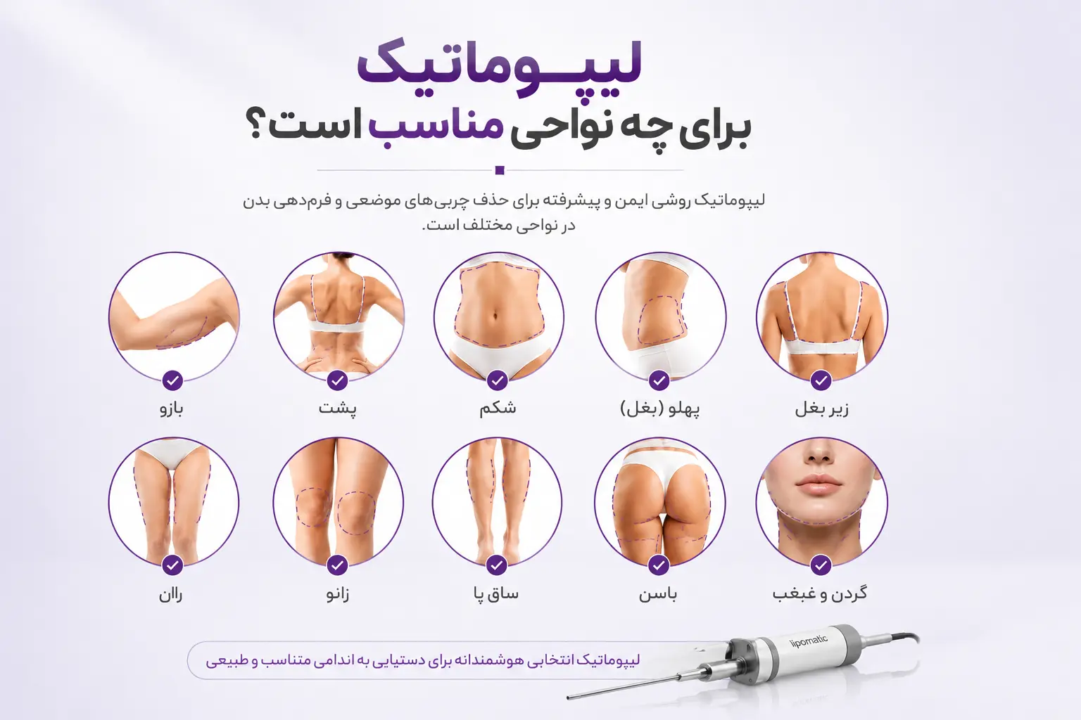نواحی مناسب برای انجام لیپوماتیک بدن