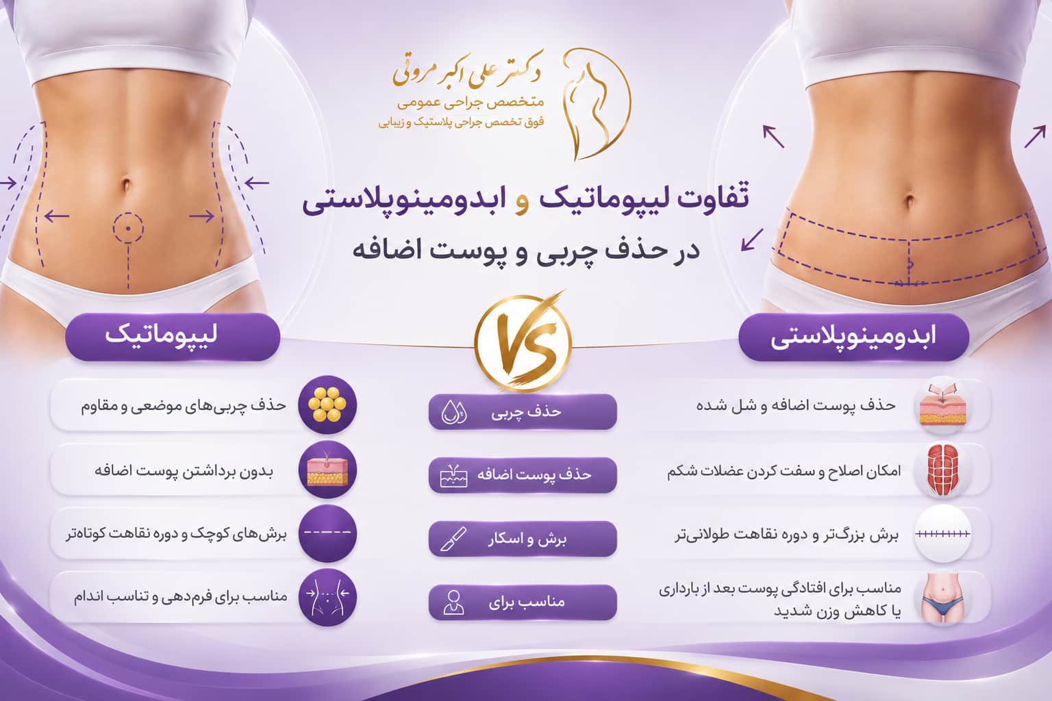 تفاوت لیپوماتیک و ابدومینوپلاستی در حذف چربی و پوست اضافه