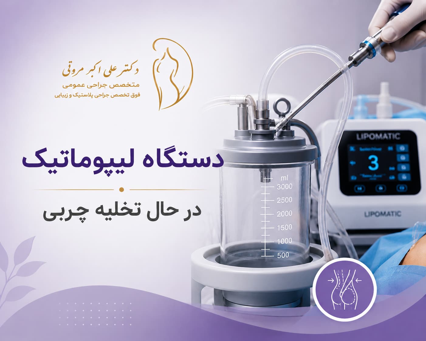 دستگاه لیپوماتیک در حال تخلیه چربی