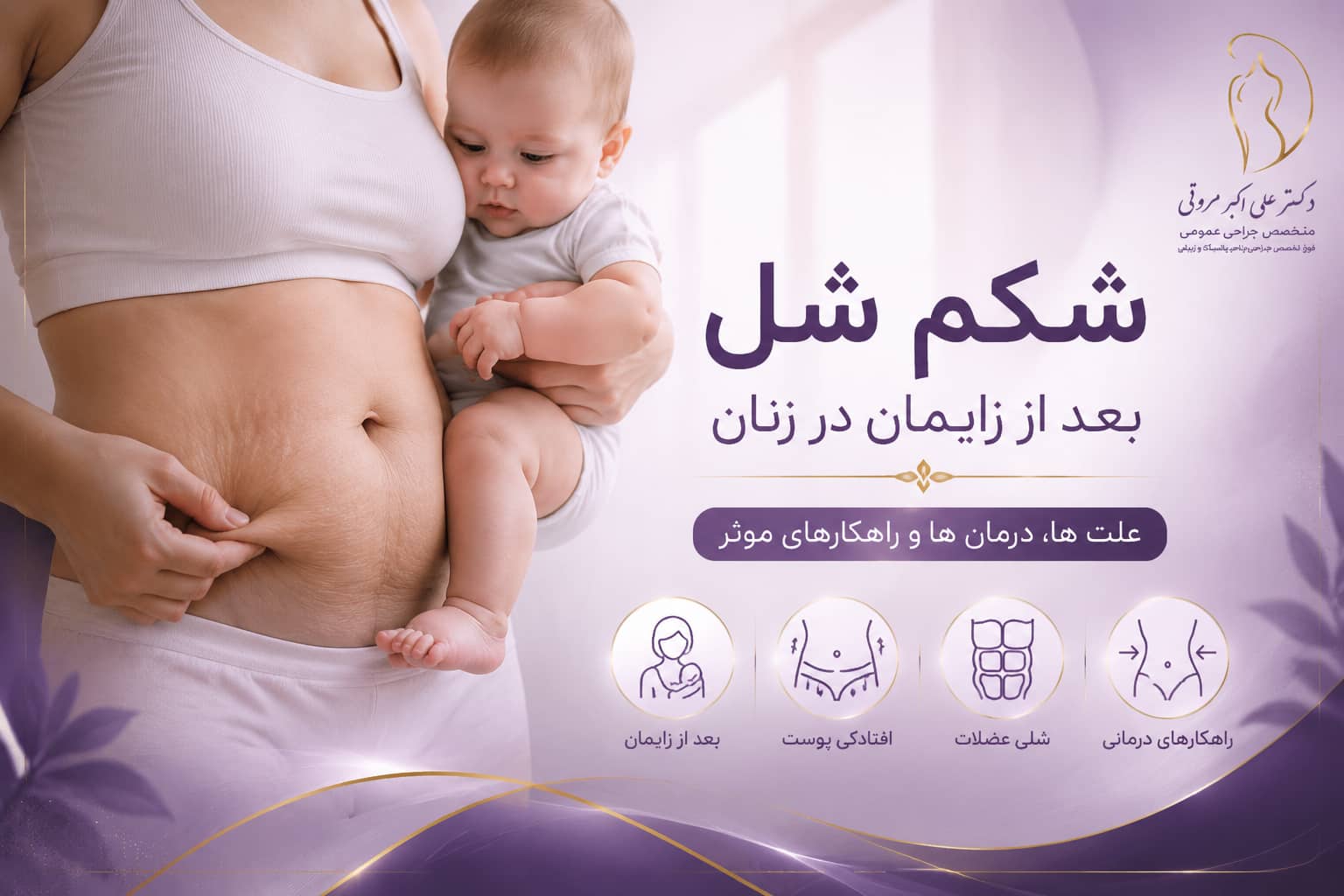 شکم شل بعد از زایمان در زنان