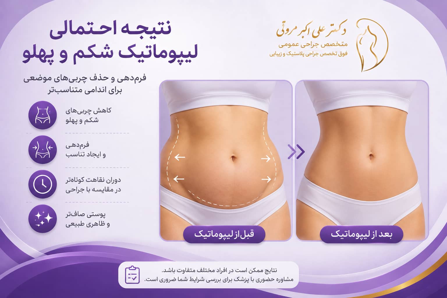 مقایسه قبل و بعد از لیپوماتیک