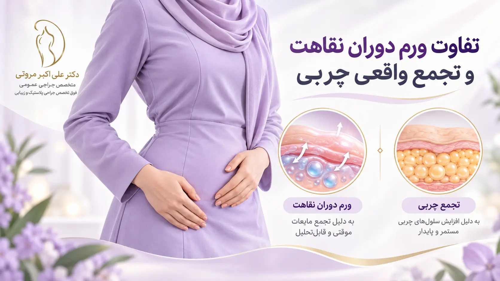 مقایسه ورم دوران نقاهت با تجمع چربی