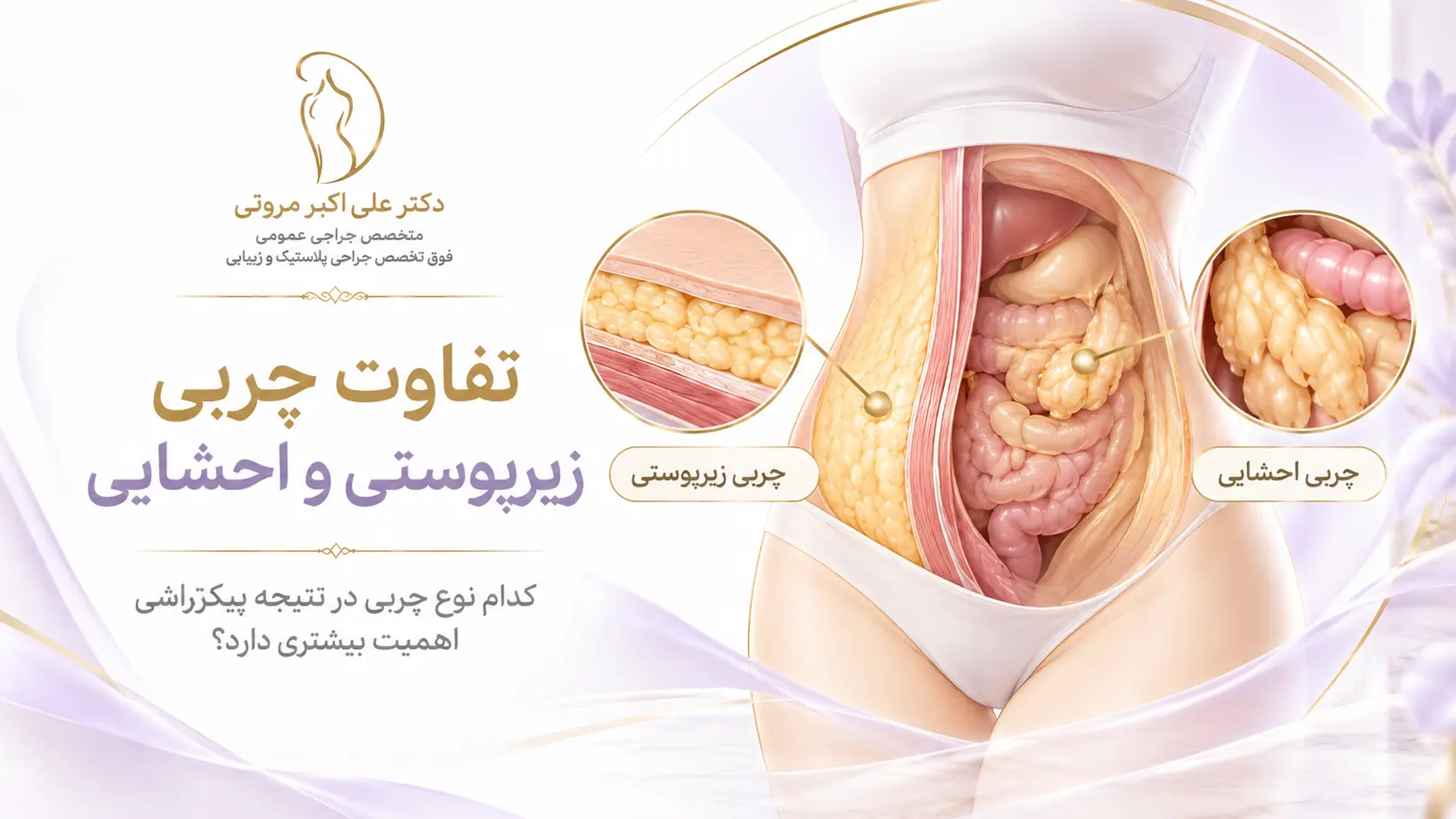 تفاوت چربی زیرپوستی و چربی احشایی شکم در انتخاب روش پیکرتراشی