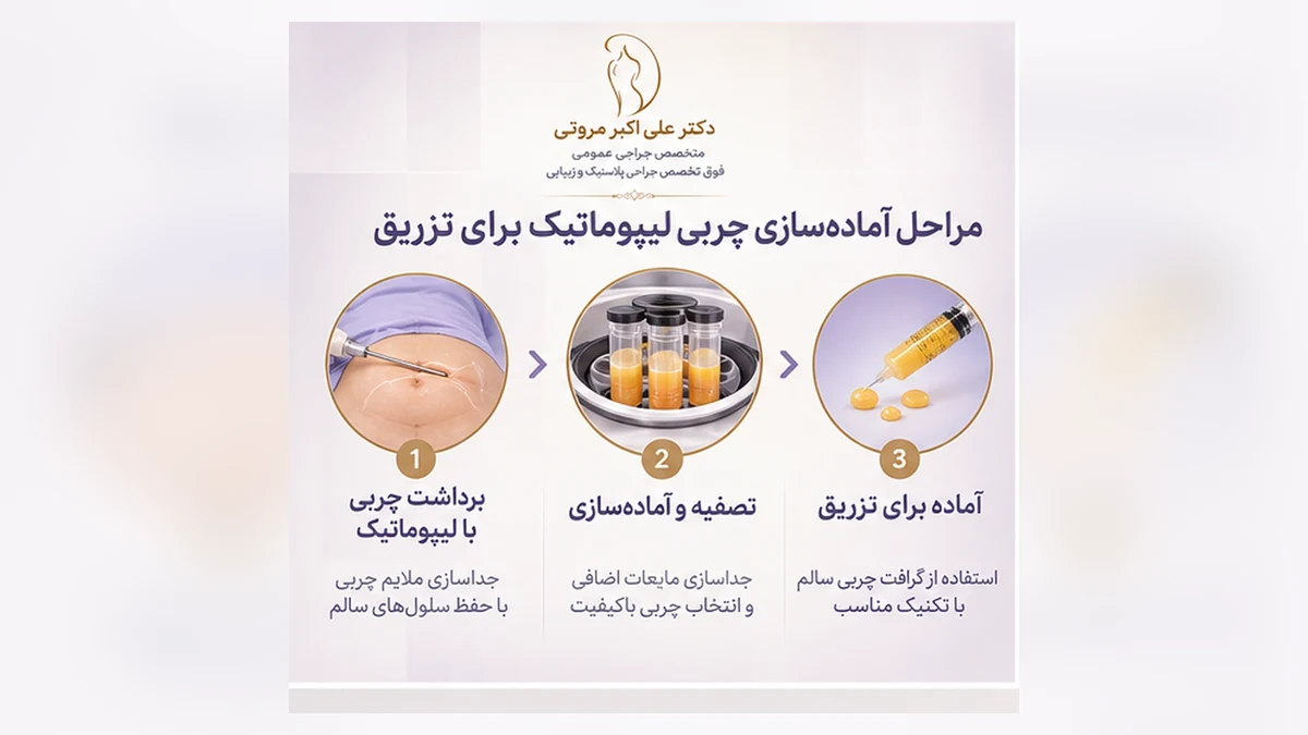 مراحل آماده سازی چربی لیپوماتیک برای تزریق مجدد