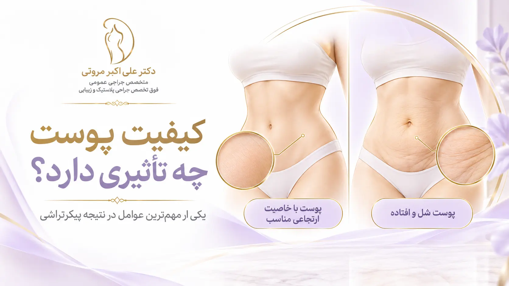 نقش خاصیت ارتجاعی و افتادگی پوست در انتخاب روش پیکرتراشی بدن